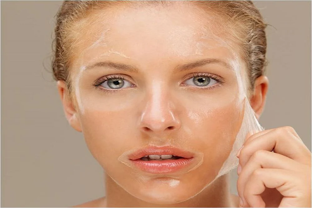 Medium Chemical Peels