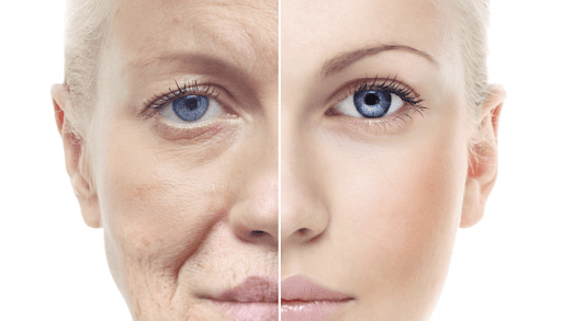 The Impact of Skin Tone Imbalances