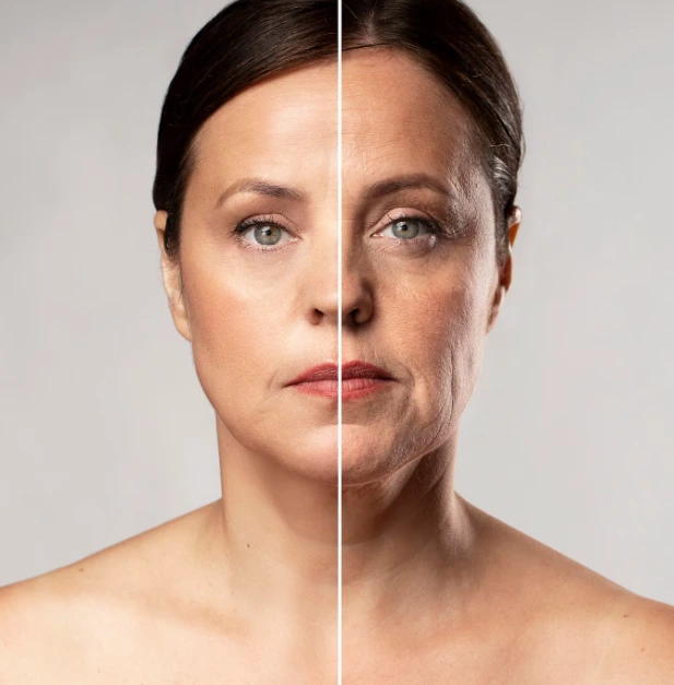 about dermal fillers