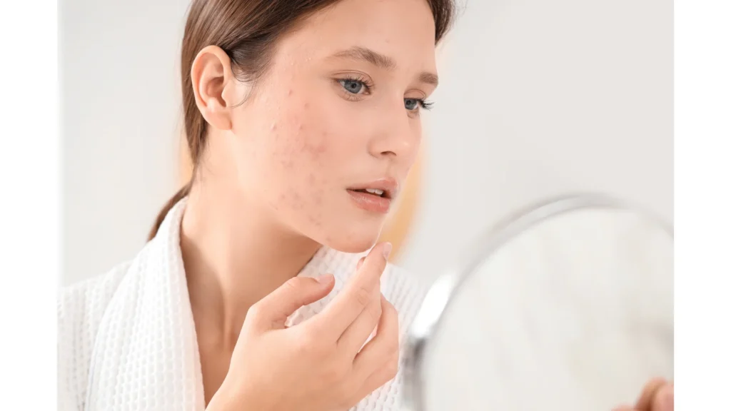 What Is Comedogenic Makeup Acne Risks and Safer Face Choice