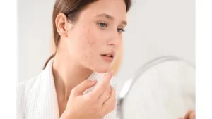 What Is Comedogenic Makeup Acne Risks and Safer Face Choice