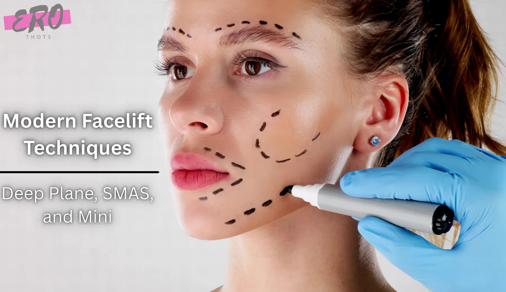 Modern Facelift Techniques