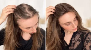 How to Hide Thinning Hair on Top Without Changing Your Hairstyle